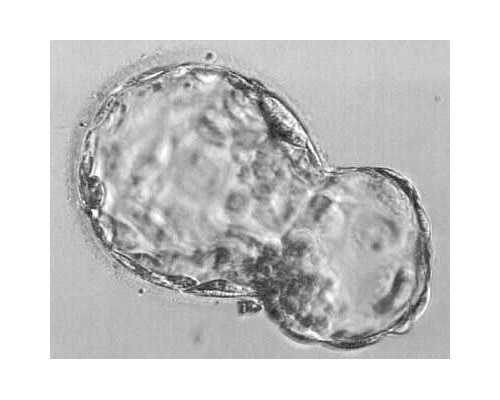 清远三代试管生龙凤胎价格是多少