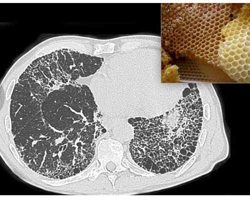 从尸体提取精子代孕！富豪从儿子尸体提取精子人工代孕了一个孙子_担⼼