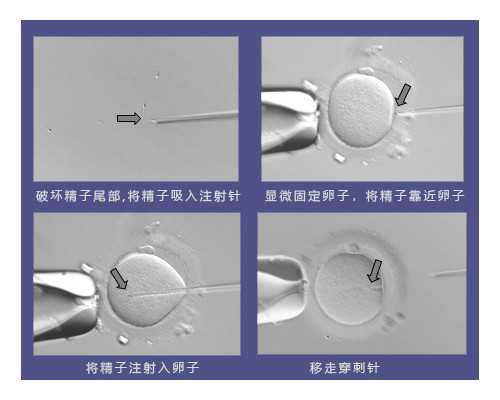 海孕试管供卵供精_供卵可以自己找吗,2024
天津医科大学总医院供卵试管费用标
