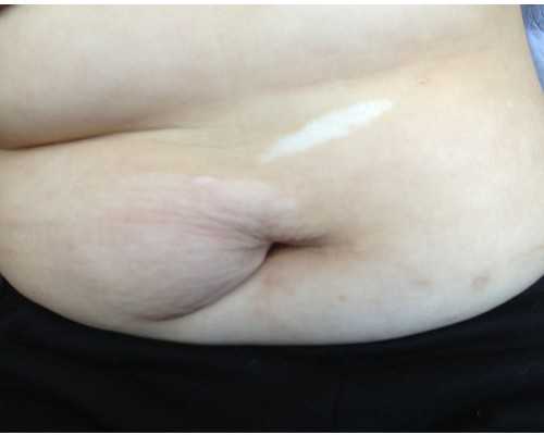 绝经供卵成功率_供卵中心有哪些,2024湘潭市中心医院可以做供卵三代试管婴儿生