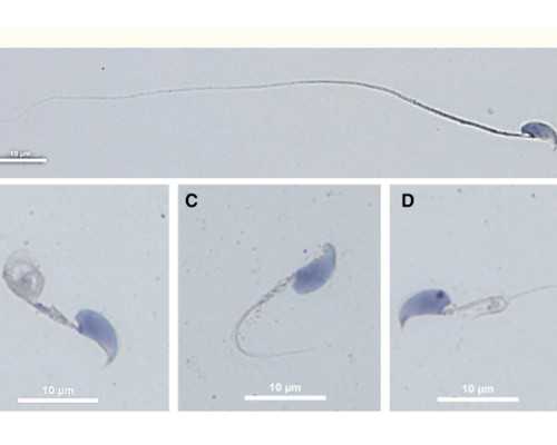 供卵三代包男孩_供卵中介,2024
天津市第一中心医院供卵试管费用预估！附供卵