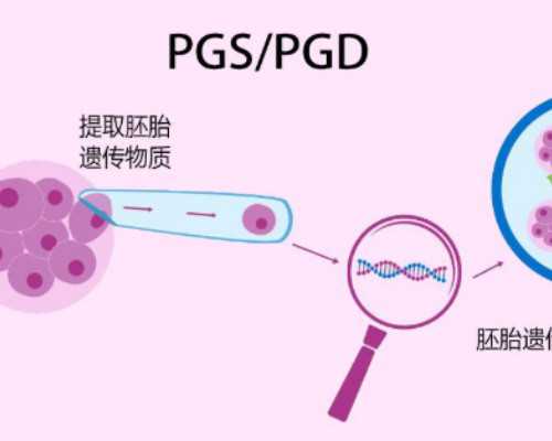 上海试管代怀生子能包男孩吗多少钱？