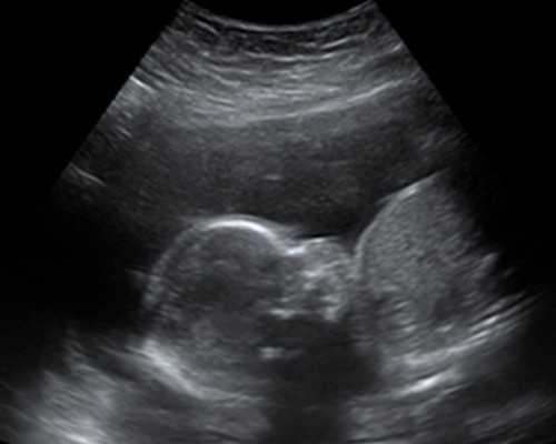 武汉正规借卵试管机构排名名单？附详细介绍？_正规的代孕公司-代孕医院费用