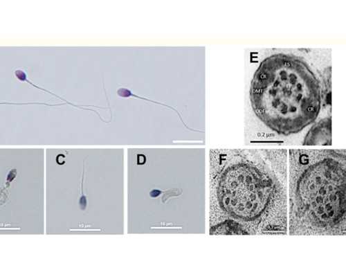 母乳黄疸的成都助孕妈妈饮食注意什么