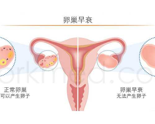 -胚胎移植_最诚信的代孕