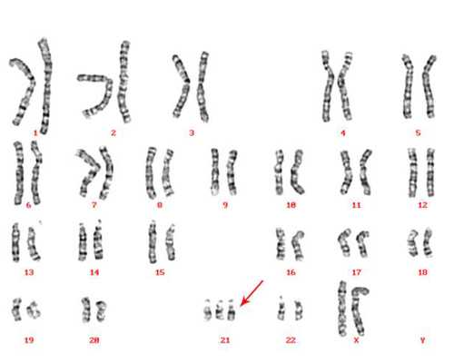 吉林私人代孕_试管代生