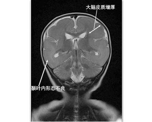 深圳助孕价格,深圳代生男孩,深圳代生妈妈-哪家医院能做代孕-捐卵代孕医院
